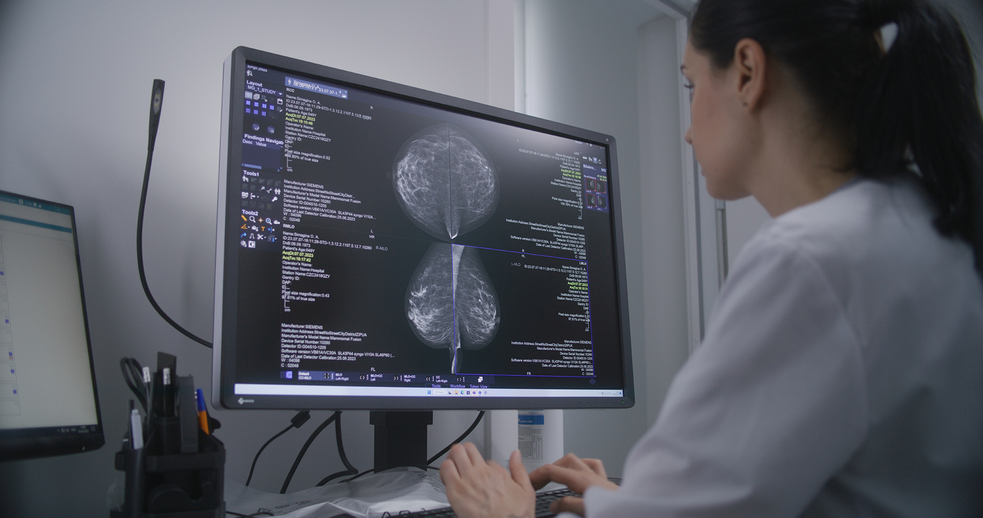 Radiologist reviewing mammograms for AI breast screening in Region Stockholm